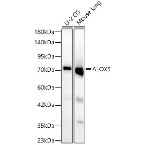 ALOX5 Rabbit mAb