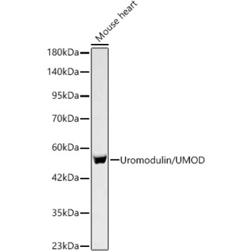 Uromodulin/UMOD Rabbit mAb
