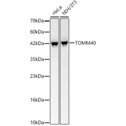 TOMM40 Rabbit mAb