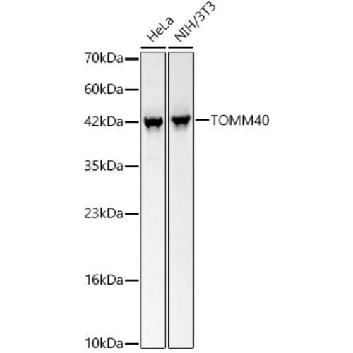 TOMM40 Rabbit mAb