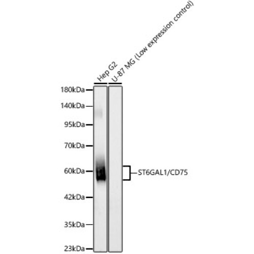 ST6GAL1/CD75 Rabbit mAb
