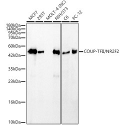 COUP-TFII/NR2F2 Rabbit mAb