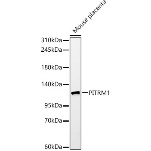 PITRM1 Rabbit mAb