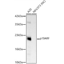 CDKN2A/p19ARF Rabbit mAb