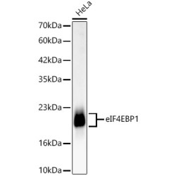 [KD Validated] eIF4EBP1 Rabbit mAb