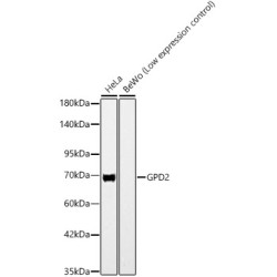 GPD2 Rabbit mAb