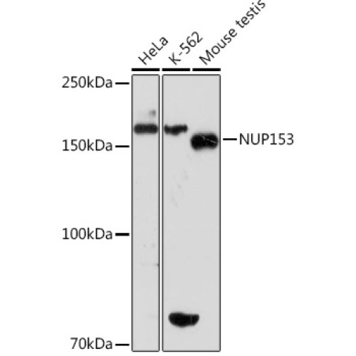 NUP153 Rabbit mAb