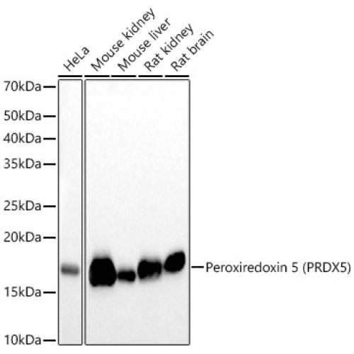[KO Validated] Peroxiredoxin 5 (PRDX5) Rabbit mAb