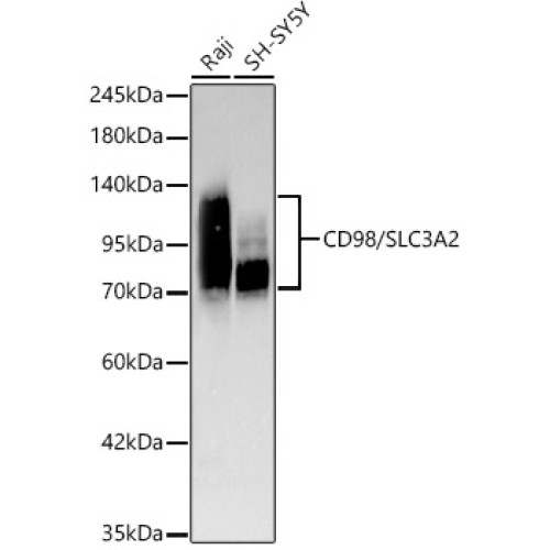 [KD Validated] CD98/SLC3A2 Rabbit mAb