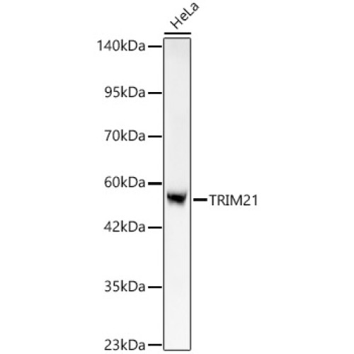 [KO Validated] TRIM21/SS-A Rabbit mAb