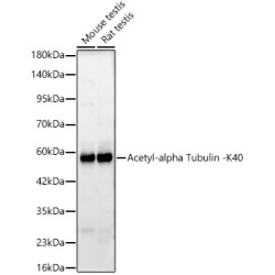 Acetyl-alpha Tubulin -K40 Rabbit mAb