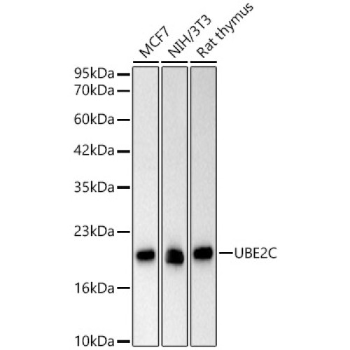UBE2C Rabbit mAb