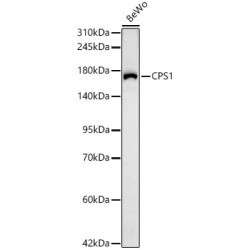CPS1 Rabbit mAb