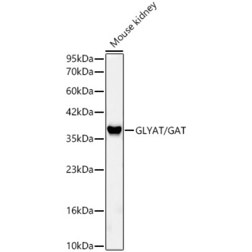 GLYAT/GAT Rabbit mAb