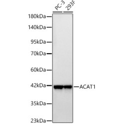 ACAT1 Rabbit mAb