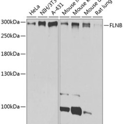 FLNB Rabbit pAb