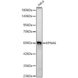 KPNA6 Rabbit mAb