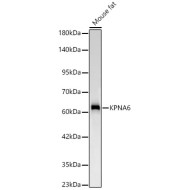 KPNA6 Rabbit mAb