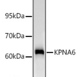 KPNA6 Rabbit mAb