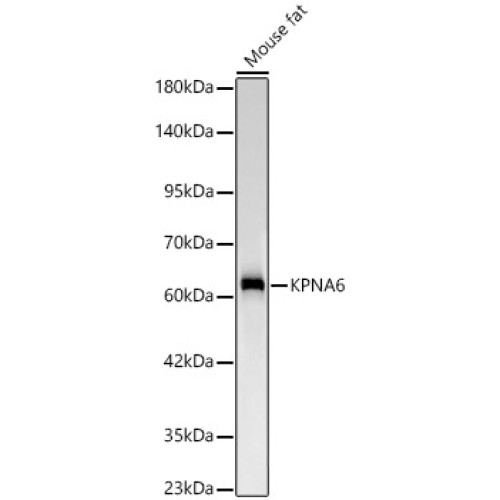 KPNA6 Rabbit mAb