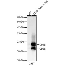 CD8β Rabbit mAb