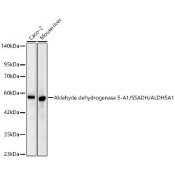 Aldehyde dehydrogenase 5-A1/SSADH/ALDH5A1  Rabbit mAb