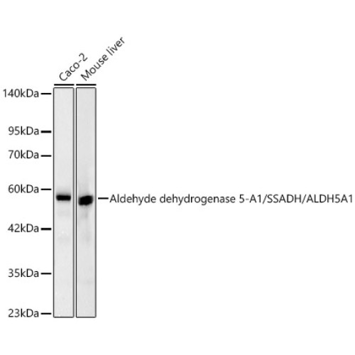 Aldehyde dehydrogenase 5-A1/SSADH/ALDH5A1  Rabbit mAb