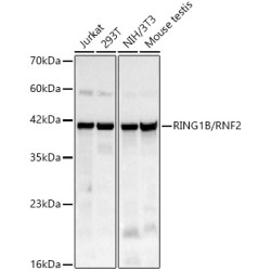 RING1B/RNF2 Rabbit mAb