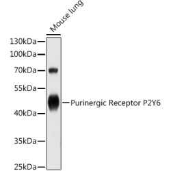 Purinergic Receptor P2Y6 Rabbit pAb