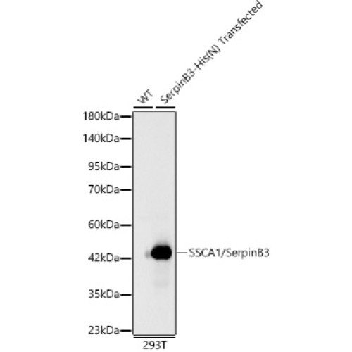 SSCA1/SerpinB3 Rabbit mAb