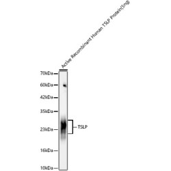 TSLP Rabbit mAb