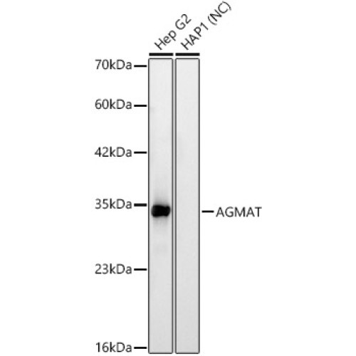 AGMAT Rabbit mAb
