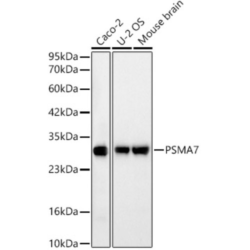 [KD Validated] PSMA7 Rabbit mAb