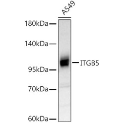 ITGB5 Rabbit pAb