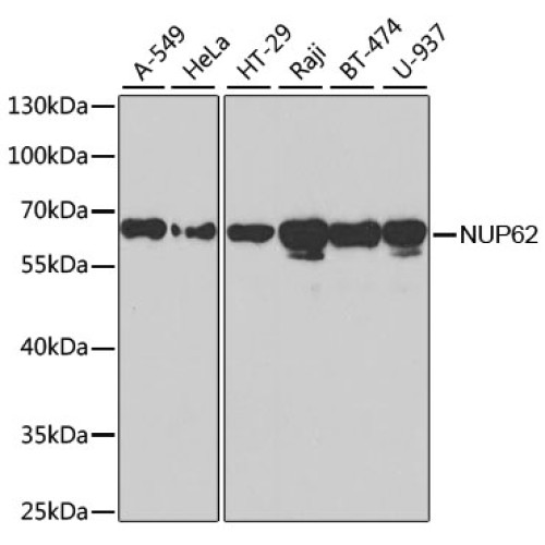 NUP62 Rabbit pAb