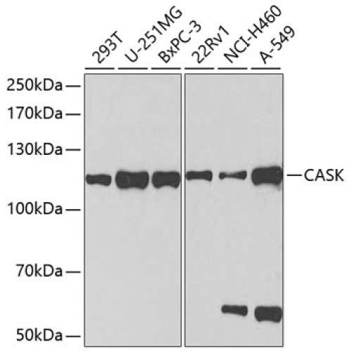 CASK Rabbit pAb