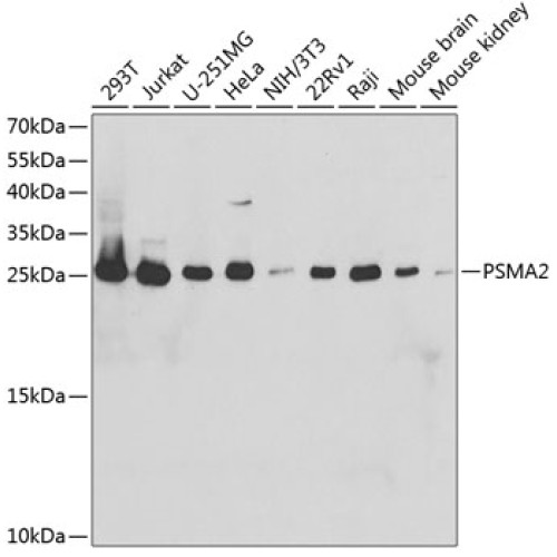 PSMA2 Rabbit pAb
