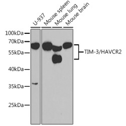 TIM-3/HAVCR2 Rabbit pAb