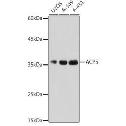 ACP5 Rabbit pAb