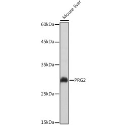 PRG2 Rabbit pAb