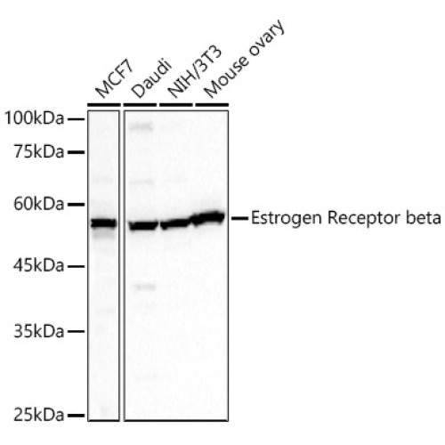 Estrogen Receptor beta Rabbit pAb