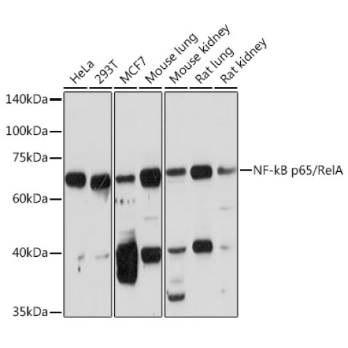 NF-kB p65/RelA Rabbit pAb