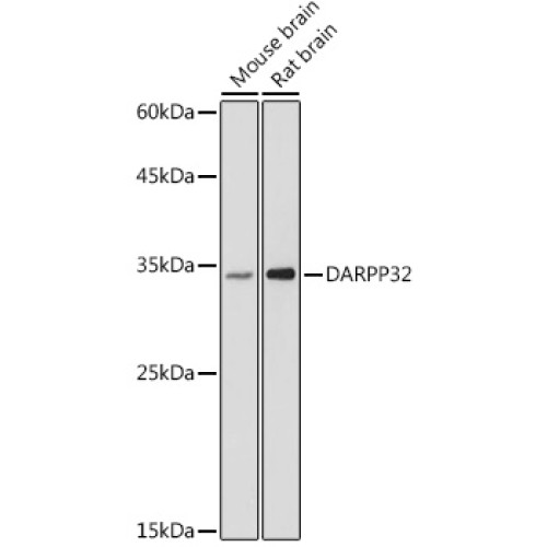 DARPP32 Rabbit pAb