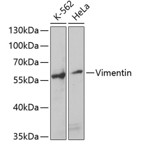 Vimentin Rabbit pAb