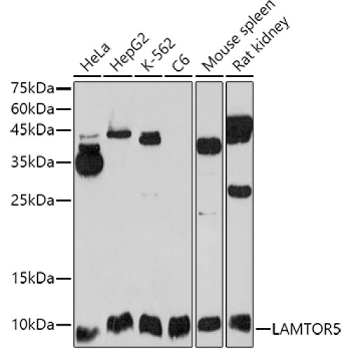 LAMTOR5 Rabbit pAb