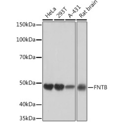FNTB Rabbit mAb