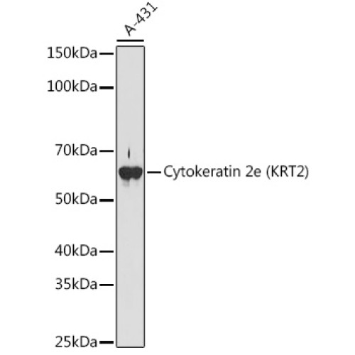 Cytokeratin 2e (KRT2) Rabbit mAb
