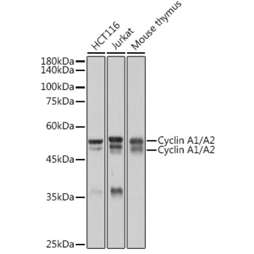 Cyclin A1/A2 Rabbit mAb