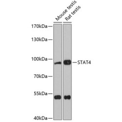 STAT4 Rabbit pAb
