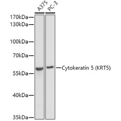 Cytokeratin 5 Rabbit pAb